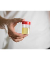 Comprar test de drogas en orina en Detecto: calidad y precisión garantizadas